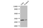 Western Blot<br />
Positive WB detected in:Mouse lung tissue,Mouse stomach tissue<br />
All lanes: TNFRSF5 antibody at 3.2ug/ml<br />
Secondary<br />
Goat polyclonal to rabbit IgG at 1/50000 dilution<br />
Predicted band size: 31,23 kDa<br />
Observed ban