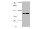 Western blot<br />
All lanes:Membrane cofactor protein antibody at 2ug/ml<br />
Lane 1:K562 whole cell lysate<br />
Lane 2:Hela whole cell lysate<br />
Secondary<br />
Goat polyclonal to rabbit at 1/10000 dilution<br />
Predicted band size: 44,45,43,41,42
