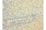 Immunohistochemistry of paraffin-embedded human tonsil tissue using CSB-PA004944ESR2HU at dilution 1:100
