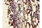 Immunohistochemistry of paraffin-embedded human lung tissue using CSB-PA004945LA01HU at dilution of 1:100