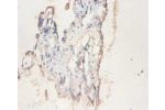 Immunohistochemistry of paraffin-embedded human placenta using CSB-PA004947EA01HU at dilution 1:100