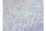 Immunohistochemistry of paraffin-embedded human tonsil using CSB-PA004951ESR2HU at dilution 1:100