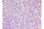 Immunohistochemistry of paraffin-embedded human tonsil using CSB-PA004953ESR1HU at dilution 1:100