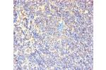 Immunohistochemistry of paraffin-embedded human lymphoid tissue using CSB-PA004953YA01HU at dilution of 1:100
