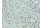 Immunohistochemistry of paraffin-embedded human epityphlon using CSB-PA004956DSR1HU at dilution 1:100
