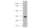 Western blot<br />
All lanes:H-2 class II histocompatibility antigen gamma chain antibody at 2ug/ml+mouse spleen tissue<br />
Secondary<br />
Goat polyclonal to Rabbit IgG at 1/15000 dilution<br />
Predicted band size: 32,25 kDa<br />
Observed band size: 