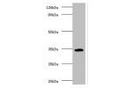 Western blot<br />
All lanes: H-2 class II histocompatibility antigen gamma chain antibody at 2ug/ml+mouse lung tissue<br />
Secondary<br />
Goat polyclonal to rabbit at 1/10000 dilution<br />
Predicted band size: 32,25kDa<br />
Observed band size: 34 kDa
