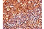 Immunohistochemistry of paraffin-embedded human tonsil tissue using CSB-PA004957LA01HU at dilution of 1:100