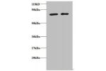 Western blot<br />
All lanes: Biogenesis of lysosome-related organelles complex 1 subunit 1 antibody at 2ug/ml<br />
Lane 1 : EC109 whole cell lysate<br />
Lane 2 : 293T whole cell lysate<br />
Secondary<br />
Goat polyclonal to Rabbit IgG at 1/15000 dilu