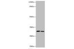 Western blot<br />
All lanes:CD82 antigen antibody at 2ug/ml<br />
Lane 1:jurkat whole cell lysate<br />
Lane 2:A549 whole cell lysate<br />
Secondary<br />
Goat polyclonal to rabbit at 1/10000 dilution<br />
Predicted band size: 30kDa<br />
Observed band