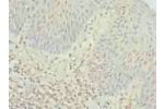 Immunohistochemistry of paraffin-embedded human tonsil tissue using CSB-PA004966LA01HU at dilution of 1:100