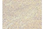 Immunohistochemistry of paraffin-embedded human tonsil tissue CSB-PA004967ESR1HU at dilution 1:100