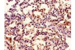 Immunohistochemistry of paraffin-embedded human lung tissue using CSB-PA004971LA01HU at dilution of 1:100
