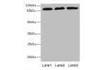 Western blot<br />
All lanes: CD97 antibody at 3.11ug/ml<br />
Lane 1 : HL60 whole cell lysate<br />
Lane 2 : HepG-2 whole cell lysate<br />
Lane 3 : Jurkat whole cell lysate<br />
Secondary<br />
Goat polyclonal to rabbit IgG at 1/10000 dilution<br />
Pr
