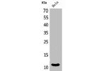 Western Blot analysis of HeLa cells using IL-8 Polyclonal Antibody