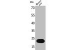 Western Blot analysis of mouse eye cells using BNIP-3 Polyclonal Antibody