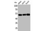 Western Blot analysis of SW480 SKOV3 HepG2 cells using c-FLIP Polyclonal Antibody