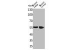 Western Blot analysis of mouse lung mouse liver cells using ALDH1A1 Polyclonal Antibody