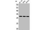 Western Blot analysis of HT29 K562 BT474 cells using BRMS-1 Polyclonal Antibody