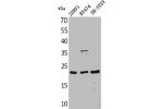 Western Blot analysis of 22RV-1 BT474 SHSY5Y cells using FGF-12 Polyclonal Antibody