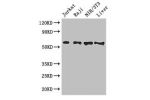 Western Blot<br />
Positive WB detected in:Jurkat whole cell lysate,Raji whole cell lysate,NIH/3T3 whole cell lysate,Mouse liver tissue<br />
All lanes: CDC25B antibody at 3ug/ml<br />
Secondary<br />
Goat polyclonal to rabbit IgG at 1/50000 dilution<br /