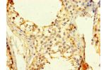 Immunohistochemistry of paraffin-embedded human testis tissue using CSB-PA004996LA01HU at dilution of 1:100