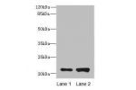 Western blot<br />
All lanes: CDC42 antibody at 6ug/ml<br />
Lane 1 : Hela whole cell lysate<br />
Lane 2 : Jurkat whole cell lysate<br />
Secondary<br />
Goat polyclonal to Rabbit IgG at 1/10000 dilution<br />
Predicted band size: 21 kDa<br />
Observed b