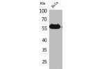 Western Blot analysis of HeLa cells using Amylase Polyclonal Antibody