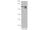 Western blot<br />
All lanes:CDC45 antibody at 1.05 ug/ml<br />
Lane 1 : K562 whole cell lysate<br />
Lane 2 : 293T whole cell lysate<br />
Secondary<br />
Goat polyclonal to rabbit IgG at 1/10000 dilution<br />
Predicted band size: 66,61,69 kDa<br />
Obs