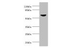 Western blot<br />
All lanes:CDC7 antibody at 0.95ug/ml+SY-5Y whole cell lysate<br />
Secondary<br />
Goat polyclonal to rabbit at 1/10000 dilution<br />
Predicted band size: 64kDa<br />
Observed band size: 64kDa<br />