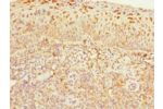 Immunohistochemistry of paraffin-embedded human tonsil tissue using CSB-PA005023ESR2HU at dilution 1:100