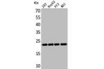Western Blot analysis of 293 HepG2 PC-3 M21 cells using FGF-6 Polyclonal Antibody