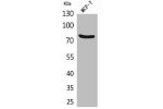 Western Blot analysis of MCF7 cells using CD66e Polyclonal Antibody