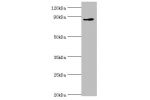 Western blot<br />
All lanes:CDH11 antibody at 6ug/ml+Jurkat whole cell lysate<br />
Secondary<br />
Goat polyclonal to rabbit at 1/10000 dilution<br />
Predicted band size: 88,77 kDa<br />
Observed band size: 88 kDa<br />
