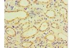 Immunohistochemistry of paraffin-embedded human kidney using CSB-PA005036ESR2HU at dilution 1:100