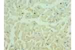 Immunohistochemistry of paraffin-embedded human heart using CSB-PA005039ESR2HU at dilution 1:100