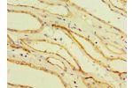 Immunohistochemistry of paraffin-embedded human kidney using CSB-PA005041ESR1HU at dilution 1:100