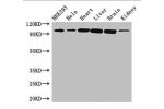 Western Blot<br />
Positive WB detected in:HEK293 whole cell lysate,Hela whole cell lysate,Mouse heart tissue,Mouse liver tissue,Mouse brain tissue,Mouse kidney tissue<br />
All lanes: CDH2 antibody at 3ug/ml<br />
Secondary<br />
Goat polyclonal to rabbi