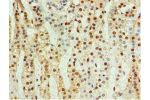 Immunohistochemistry of paraffin-embedded human adrenal gland using CSB-PA005060ESR2HU at dilution 1:100