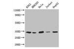 Western Blot<br />
Positive WB detected in:K562 whole cell lysate,HEK293 whole cell lysate,Hela whole cell lysate,Jurkat whole cell lysate,HepG2 whole cell lysate<br />
All lanes: CDK2 antibody at 2.6ug/ml<br />
Secondary<br />
Goat polyclonal to rabbit I