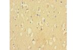 Immunohistochemistry of paraffin-embedded human brain tissue using CSB-PA005063LA01HU at dilution 1:100