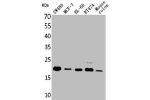 Western Blot analysis of SW480 MCF-7 HL-60 BT474 mouse colon cells using FGF-20 Polyclonal Antibody