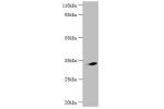 Western blot<br />
All lanes:Cyclin-dependent kinase 5 antibody at 2ug/ml+mouse brain tissue<br />
Secondary<br />
Goat polyclonal to rabbit at 1/10000 dilution<br />
Predicted band size: 34,30 kDa<br />
Observed band size: 33 kDa<br />