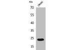 Western Blot analysis of SW480 cells using FGF-9 Polyclonal Antibody