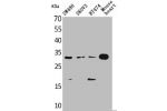 Western Blot analysis of SW480 SKOV3 BT474 mouse heart cells using FGF-18 Polyclonal Antibody