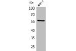 Western Blot analysis of MCF7 cells using ALK-1 Polyclonal Antibody