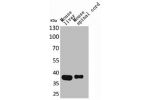 Western Blot analysis of mouse liver mouse spinal cord cells using Aldolase C Polyclonal Antibody