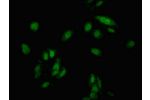 Immunofluorescent analysis of Hela cells  using CSB-PA005088LA01HU at a dilution of 1:100 and Alexa Fluor 488-congugated AffiniPure Goat Anti-Rabbit IgG(H+L)