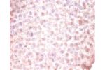 Immunohistochemistry of paraffin-embedded mouse liver using CSB-PA005091LA01HU at dilution of 1:100