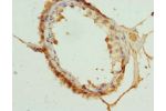 Immunohistochemistry of paraffin-embedded human testis tissue using CSB-PA005095DSR1HU at dilution 1:100